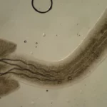 Considérez le parasite