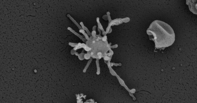 Microorganismo del grupo Asgard, posible ancestro común de animales, plantas y hongos.