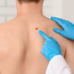 Une nouvelle étude révèle que les cabines de bronzage triplent le risque de mélanome et provoquent deux fois plus de mutations génétiques sur presque toutes les peaux, pas seulement sur les zones exposées.