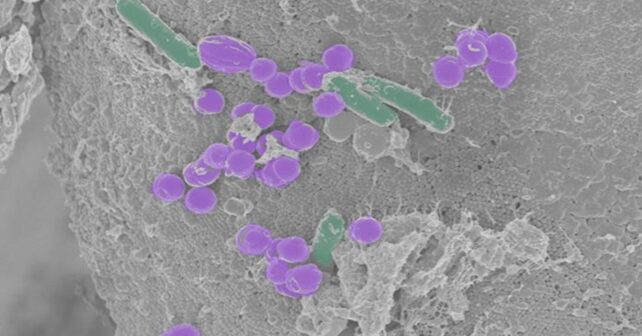 Crean una célula sintética capaz de crecer y reproducirse sin estar viva